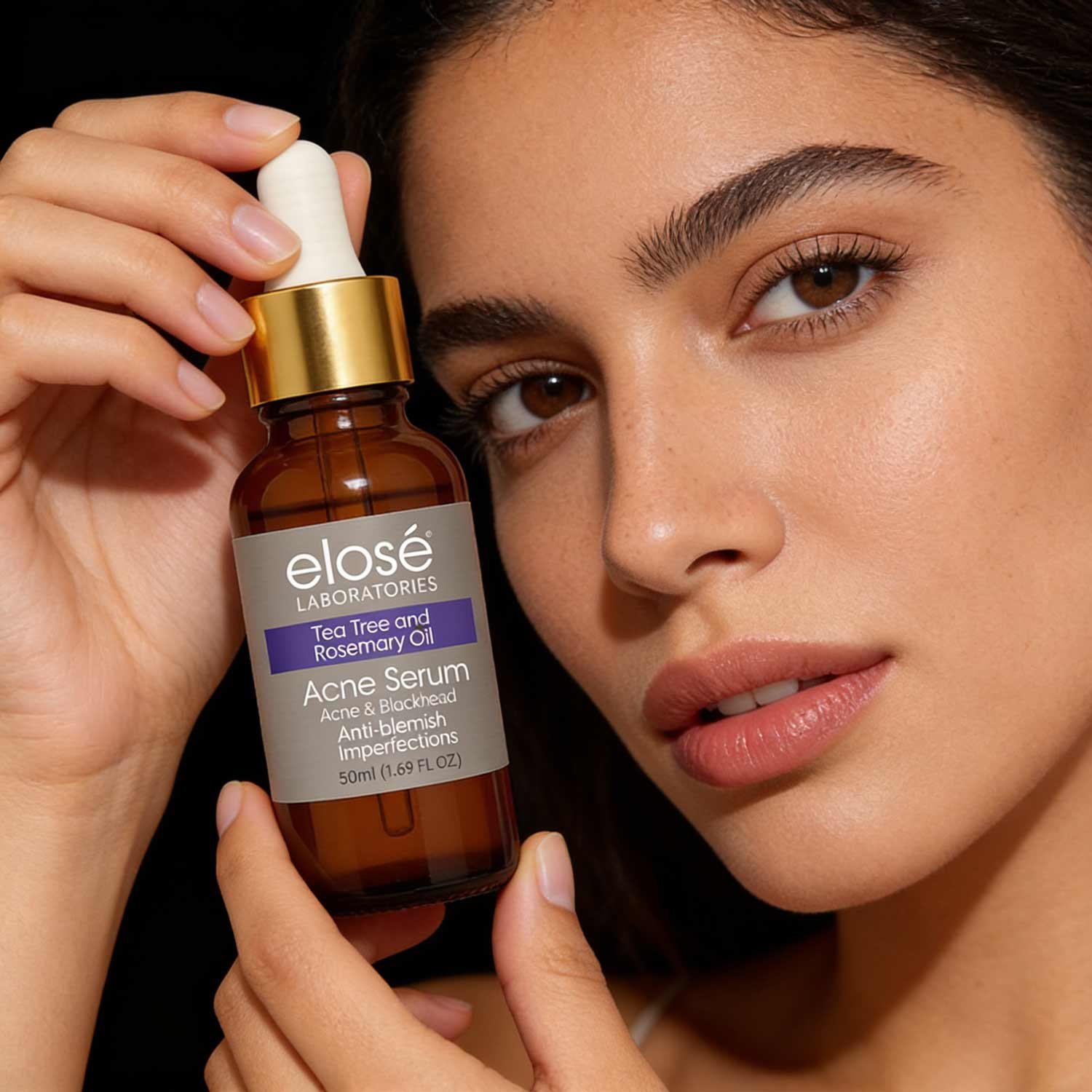 eloseacneinfluencer